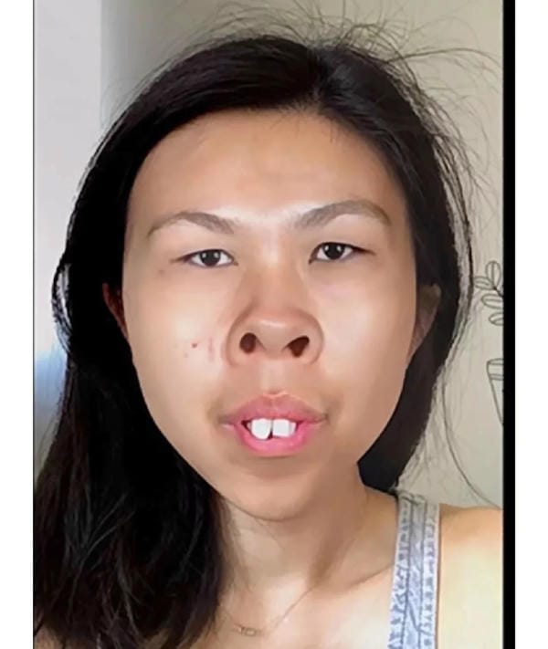 hình ảnh con gái xấu